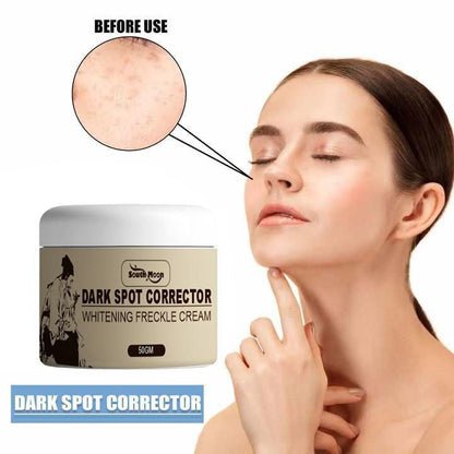 Dark Spot Corrector Whitening Frackle Cream 50g